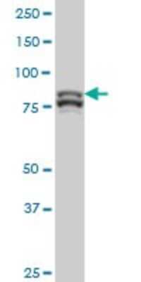 Western Blot: MTA1 Antibody (4D5) [H00009112-M01]