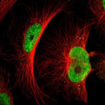 Immunocytochemistry/ Immunofluorescence: MTA1 Antibody [NBP1-89467]