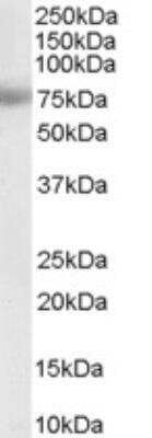 Western Blot: MTA1 Antibody [NB100-823]