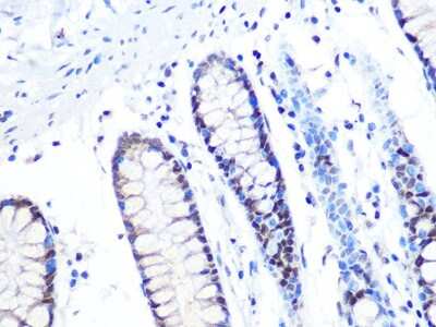 Immunohistochemistry-Paraffin: MTA2 Antibody (9A5Y7) [NBP3-16291]
