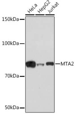 Western Blot: MTA2 Antibody (9A5Y7) [NBP3-16291]