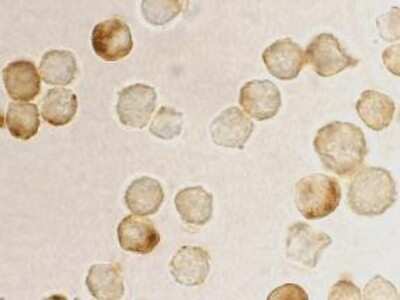 Immunocytochemistry/ Immunofluorescence: MTA2 Antibody - BSA Free [NBP1-76748]