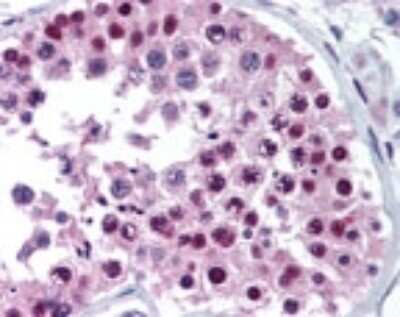 Immunohistochemistry: MTA2 Antibody [NB100-56483]