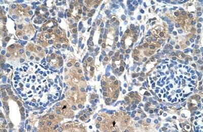 Immunohistochemistry: MTA2 Antibody [NBP2-87852]