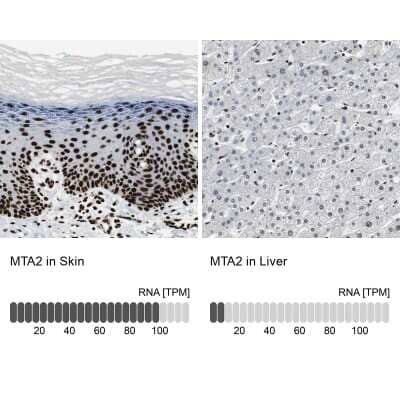 Immunohistochemistry-Paraffin: MTA2 Antibody [NBP1-82615]