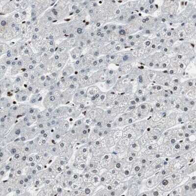 Immunohistochemistry-Paraffin: MTA2 Antibody [NBP1-82615]