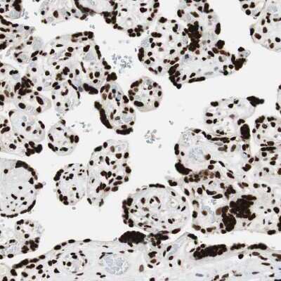 Immunohistochemistry-Paraffin: MTA2 Antibody [NBP1-82615]