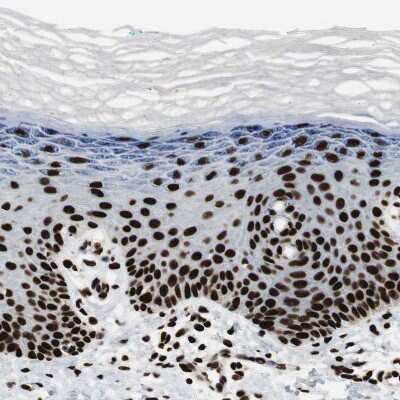 Immunohistochemistry-Paraffin: MTA2 Antibody [NBP1-82615]