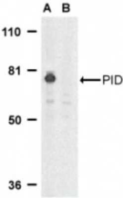 Western Blot: MTA2 AntibodyBSA Free [NBP1-76748]