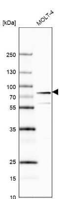 Western Blot: MTA2 Antibody [NBP1-82615]