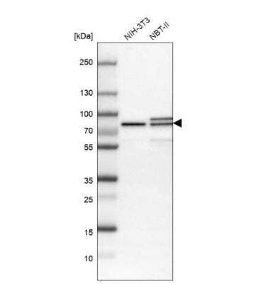 Western Blot: MTA2 Antibody [NBP1-82615]
