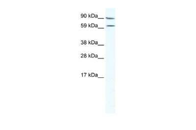 Western Blot: MTA2 Antibody [NBP2-87849]