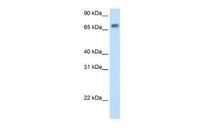 Western Blot: MTA2 Antibody [NBP2-87850]