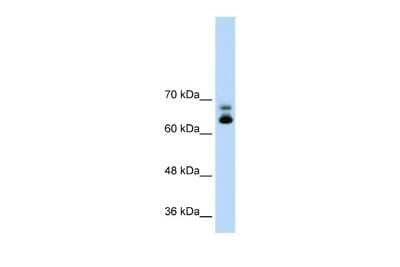 Western Blot: MTA2 Antibody [NBP2-87852]