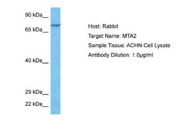 Western Blot: MTA2 Antibody [NBP2-87853]