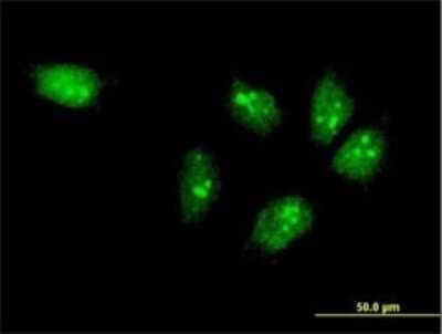 Immunocytochemistry/ Immunofluorescence: MTA3 Antibody (2C5) [H00057504-M06]