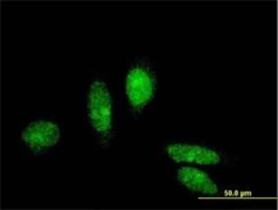 Immunocytochemistry/ Immunofluorescence: MTA3 Antibody (3B3) [H00057504-M02]