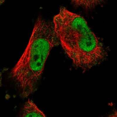 Immunocytochemistry/ Immunofluorescence: MTA3 Antibody [NBP1-82919]