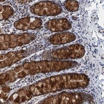 Immunohistochemistry-Paraffin: MTA3 Antibody [NBP1-82919]