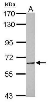 Western Blot: MTA3 Antibody [NBP2-19424]