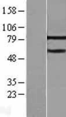 Western Blot: MTA3 Overexpression Lysate [NBL1-13352]