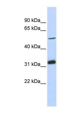 Western Blot: MTAC2D1 Antibody [NBP1-55422]