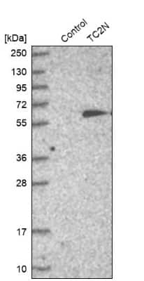 Western Blot: MTAC2D1 Antibody [NBP1-89900]