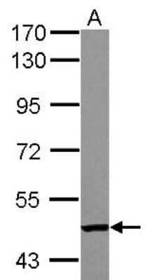 Western Blot: MTAC2D1 Antibody [NBP2-19425]