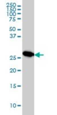Western Blot: MTAP Antibody (2G4) [H00004507-M01]