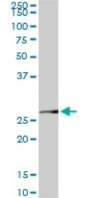 Western Blot: MTAP Antibody (2G4) [H00004507-M01]