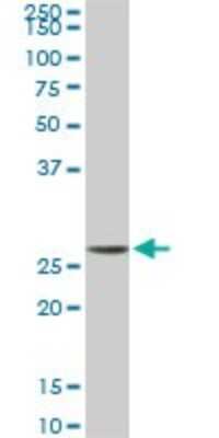 Western Blot: MTAP Antibody (2G4) [H00004507-M01]