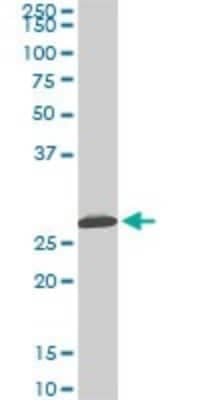 Western Blot: MTAP Antibody (2G4) [H00004507-M01]