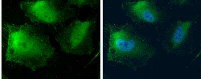 Immunocytochemistry/ Immunofluorescence: MTAP Antibody [NBP1-32718]
