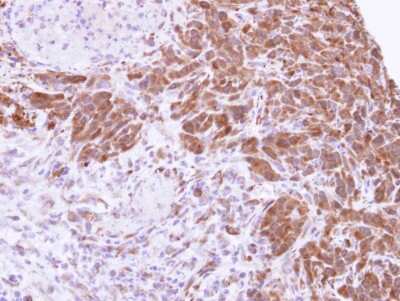 Immunohistochemistry-Paraffin: MTAP Antibody [NBP1-32718]