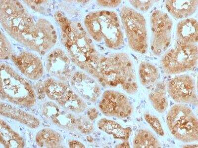 Immunohistochemistry-Paraffin: MTAP Antibody (MTAP/1813) [NBP2-75730]