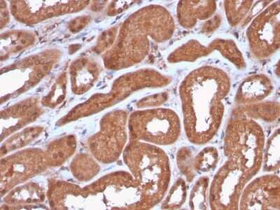 Immunohistochemistry-Paraffin: MTAP Antibody (MTAP/3137R) [NBP3-07220]