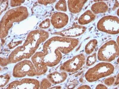 Immunohistochemistry-Paraffin: MTAP Antibody (MTAP/3137R) [NBP3-07220]
