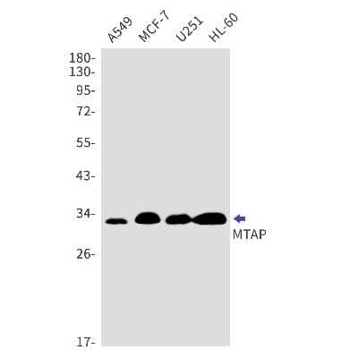 Western Blot: MTAP Antibody (S07-5A0) [NBP3-14956]