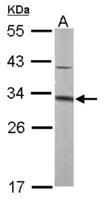 Western Blot: MTAP Antibody [NBP1-32718]