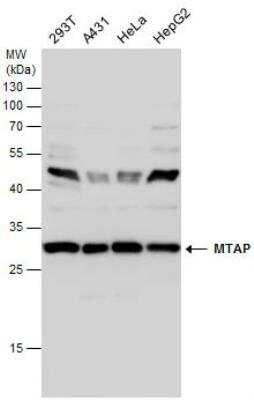 Western Blot: MTAP Antibody [NBP1-32718]