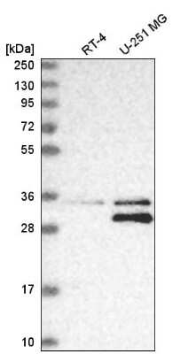 Western Blot: MTAP Antibody [NBP2-56796]