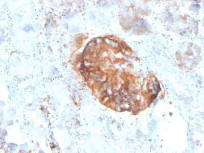 Immunohistochemistry-Paraffin: MTAP Antibody (rMTAP/1813) - Azide and BSA Free [NBP3-08964]