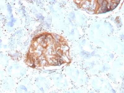 Immunohistochemistry-Paraffin: MTAP Antibody (rMTAP/1813) - Azide and BSA Free [NBP3-08964]