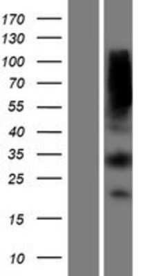 Western Blot: MTAP Overexpression Lysate [NBP2-08113]