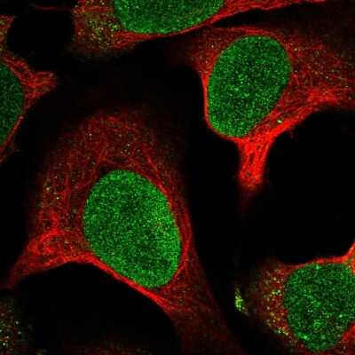 Immunocytochemistry/ Immunofluorescence: MTBP Antibody [NBP2-55351]