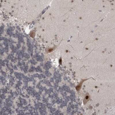 Immunohistochemistry-Paraffin: MTBP Antibody [NBP1-86408]
