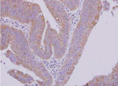 Immunohistochemistry-Paraffin: MTBP Antibody [NBP2-19427]