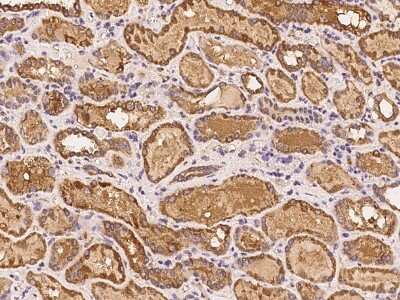 Immunohistochemistry-Paraffin: MTBP Antibody [NBP2-98002]