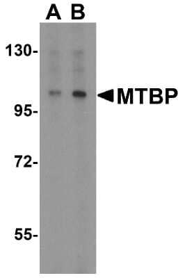 Western Blot: MTBP AntibodyBSA Free [NBP1-76747]