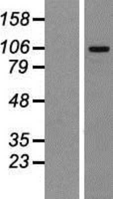 Western Blot: MTBP Overexpression Lysate [NBP2-06485]